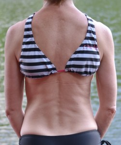 J'ai trouvé que ma cicatrice ressemblait à une colonne vertébrale.